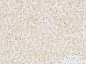 Immunohistochemical analysis of paraffin-embedded human liver using Anti-TNNT2 Antibody