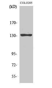 Western blot analysis of various cells using Anti-JMY Antibody