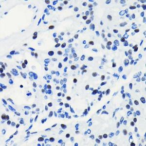 Anti-BRG1 Rabbit Monoclonal Antibody [clone: ARC0035]