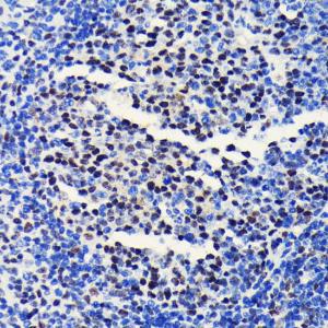 Anti-BRG1 Rabbit Monoclonal Antibody [clone: ARC0035]