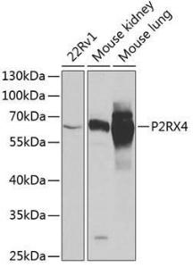 Western blot analysis of extracts of various cell lines, using Anti-P2X4 Antibody (A12004) at 1:1,000 dilution The secondary antibody was Goat Anti-Rabbit IgG H&L Antibody (HRP) at 1:10,000 dilution Lysates/proteins were present at 25 µg per lane