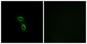 Anti-ARMC6 antibody