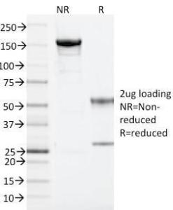 SDS-PAGE analysis of Anti-ARF1 Antibody [ARF1/2117] under non-reduced and reduced conditions; showing intact IgG and intact heavy and light chains, respectively. SDS-PAGE analysis confirms the integrity and purity of the antibody.