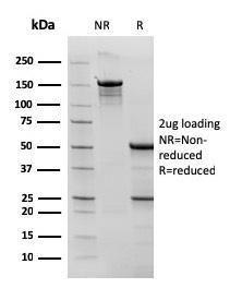 SDS-PAGE analysis of Anti-Bcl-6 Antibody [rBCL6/1527] under non-reduced and reduced conditions; showing intact IgG and intact heavy and light chains, respectively. SDS-PAGE analysis confirms the integrity and purity of the antibody