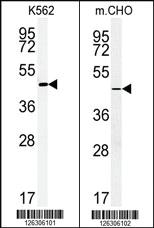 Anti-ENTPD8 Rabbit Polyclonal Antibody