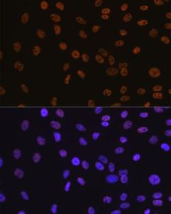 Anti-BRG1 Rabbit Monoclonal Antibody [clone: ARC0035]