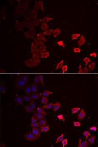 Immunofluorescence analysis of MCF7 cells using Anti-P2X4 Antibody (A12004) DAPI was used to stain the cell nuclei (blue)