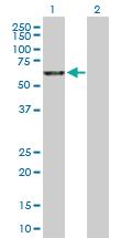 Anti-RBM5 Rabbit Polyclonal Antibody