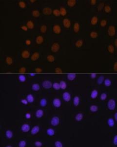 Anti-BRG1 Rabbit Monoclonal Antibody [clone: ARC0035]