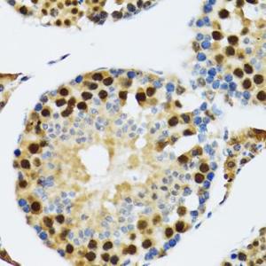 Immunohistochemistry analysis of paraffin-embedded rat testis using Anti-TXNL1 Antibody (A307964) at a dilution of 1:100 (40x lens). Perform microwave antigen retrieval with 10 mM PBS buffer pH 7.2 before commencing with IHC staining protocol.