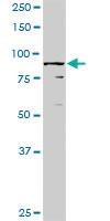 Anti-RBM5 Rabbit Polyclonal Antibody