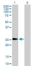 Anti-PIP5K1C Rabbit Polyclonal Antibody