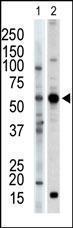 Anti-PACSIN2 Rabbit Polyclonal Antibody (PE (Phycoerythrin))