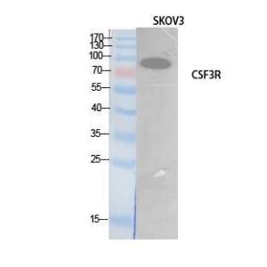 Western blot analysis of extracts from SKOV3 cells using Anti-CSF3R Antibody