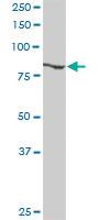 Anti-RBM5 Rabbit Polyclonal Antibody