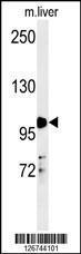 Anti-NR3C1 Rabbit Polyclonal Antibody