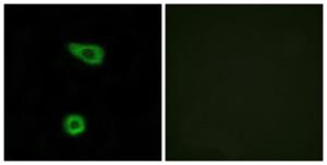 Immunofluorescence analysis of HUVEC cells using Anti-TNAP2 Antibody The right hand panel represents a negative control, where the antibody was pre-incubated with the immunising peptide