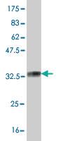 Anti-SOX12 Mouse Monoclonal Antibody [clone: 2D3]