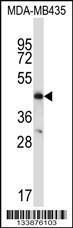 Anti-CCR9 Rabbit Polyclonal Antibody (PE (Phycoerythrin))