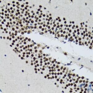 Immunohistochemistry analysis of paraffin-embedded rat brain using Anti-TXNL1 Antibody (A307964) at a dilution of 1:100 (40x lens). Perform microwave antigen retrieval with 10 mM PBS buffer pH 7.2 before commencing with IHC staining protocol.