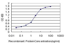 Anti-PIP5K1C Mouse Monoclonal Antibody [clone: 7D11]