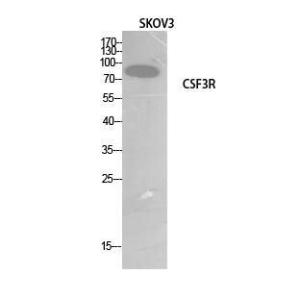 Western blot analysis of SKOV3 cells using Anti-CSF3R Antibody