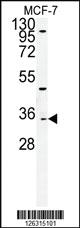 Anti-TTPAL Rabbit Polyclonal Antibody