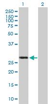 Anti-IFIH1 Mouse Polyclonal Antibody