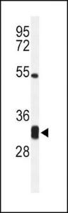 Anti-CPSF4 Rabbit Polyclonal Antibody (PE (Phycoerythrin))