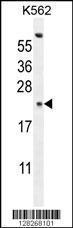 Anti-GAGE13 Rabbit Polyclonal Antibody (FITC (Fluorescein Isothiocyanate))