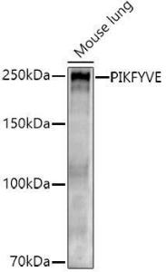 Western blot analysis of extracts of Mouse lung, using Anti-PIP5K3 / PIKFYVE Antibody (A12006) at 1:500 dilution