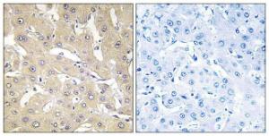 Immunohistochemical analysis of paraffin-embedded human liver carcinoma tissue using Anti-TNAP2 Antibody The right hand panel represents a negative control, where the antibody was pre-incubated with the immunising peptide