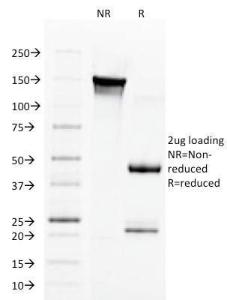 SDS-PAGE analysis of Anti-Aurora B Antibody [AURKB/1592] under non-reduced and reduced conditions; showing intact IgG and intact heavy and light chains, respectively. SDS-PAGE analysis confirms the integrity and purity of the antibody