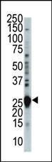 Anti-CDKN3 Rabbit Polyclonal Antibody (PE (Phycoerythrin))