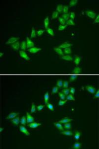 Immunofluorescence analysis of U2OS cells using Anti-TXNL1 Antibody (A307964). DAPI was used to stain the cell nuclei (blue).