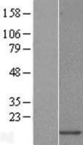 Anti-CYLD Rabbit Polyclonal Antibody