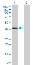 Anti-IL4R Mouse Polyclonal Antibody