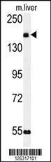 Anti-CCDC180 Rabbit Polyclonal Antibody