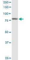 Anti-PFKP Mouse Polyclonal Antibody