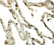 Anti-TSN Rabbit Polyclonal Antibody