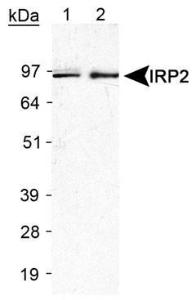 Anti-NKX3-1 Mouse Monoclonal Antibody (DyLight® 488) [clone: 0361]