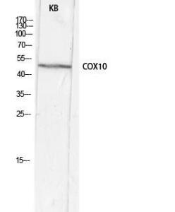 Western blot analysis of KB lysis using Anti-COX10 Antibody