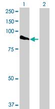 Anti-PFKP Mouse Polyclonal Antibody