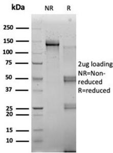 SDS-PAGE analysis of Anti-RBMS2 Antibody [PCRP-RBMS2-1B6] under non-reduced and reduced conditions; showing intact IgG and intact heavy and light chains, respectively. SDS-PAGE analysis confirms the integrity and purity of the antibody