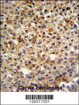 Anti-CCDC180 Rabbit Polyclonal Antibody