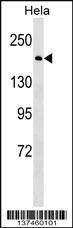 Anti-BRCA1 Rabbit Polyclonal Antibody