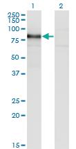 Anti-RBM5 Mouse Monoclonal Antibody [clone: 3G6]