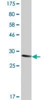 Anti-CLDN4 Mouse Monoclonal Antibody [clone: 4A4]