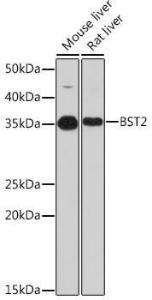 Western blot analysis of extracts of various cell lines, using Anti-BST2/Tetherin Antibody [ARC1321] (A306695) at 1:1,000 dilution The secondary antibody was Goat Anti-Rabbit IgG H&L Antibody (HRP) at 1:10,000 dilution Lysates/proteins were present at 25 µg per lane