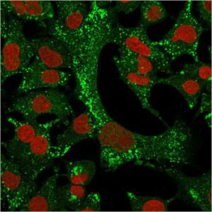 Anti-Cytokeratin 4 antibody